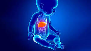 Hepatoblastoma liver tumor in infants and young children